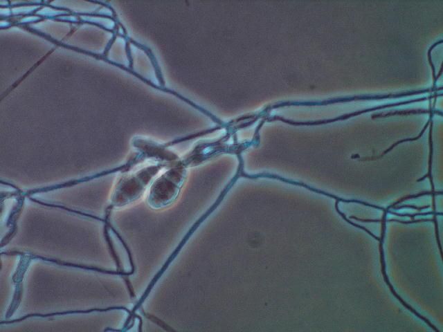 Figure 1. Microscopic threads (hyphae) and spores of a typical plant-pathogenic fungus.