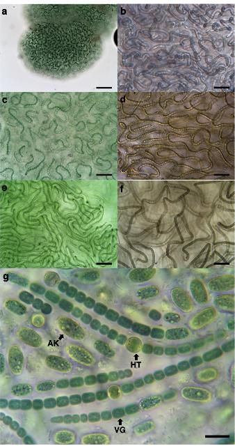 Figure 1. Imágenes de microscopio de Nostoc que indican a) formación de colonias en el mucílago, b–f) colonias de diversas morfologías y pigmentación y g) tricomas individuales de células con heterocitos (HT), células vegetativas (VG) y acinetos (AK). Las barras representan a) 100 μm, b–f) 50 μm y g) 20 μm.