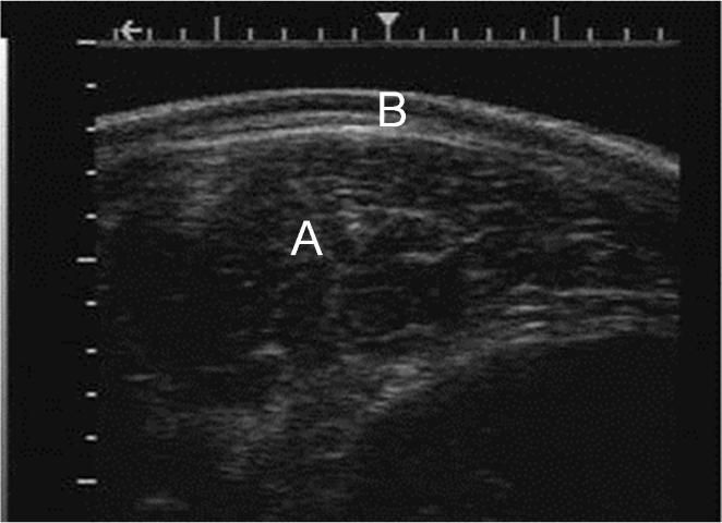 Figure 3. Example real-time ultrasound image of the ribeye (A) and overlying backfat (B).