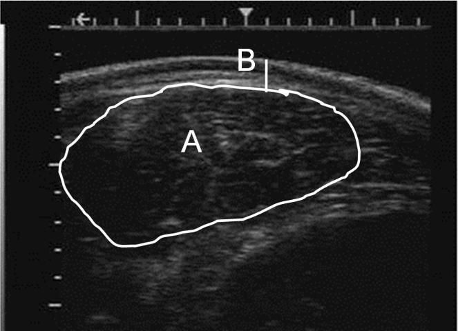 Figure 5. Real-time ultrasound image with ribeye area (A) and backfat depth measured at ¾ the distance from middle of the animal (B) at the 12th/13th rib location.