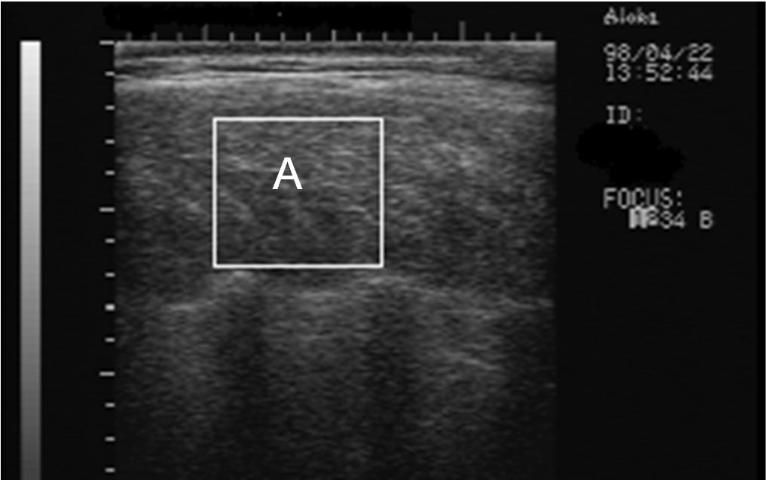 Figure 8. Real-time ultrasound image of a longitudinal rib scan (11th–13th rib) to estimate marbling (or intramuscular fat) within the ribeye. The area within the box (A) is interpreted by the computer to estimate the percentage of intramuscular fat.