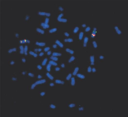 Figure 1. Equine chromosomes from a single cell stained with a fluorescent blue dye and viewed under a microscope. Three individual genes on one pair of chromosomes are marked with green, orange, and red dye.