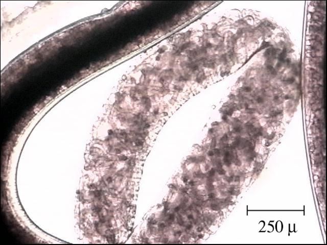 Figure 13. Close up of a Camallanus sp. female showing larvae inside.