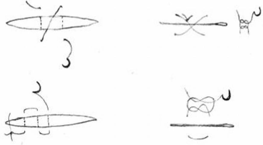 Figure 5. Surgical knots. We recommend a single or interrupted X-suture pattern stitch for tying and anchoring the suture. For a long incision (3–5 cm or longer), we recommend a horizontal mattress suture. Proper knot tying requires not only manipulative skill but most importantly considerable practice.