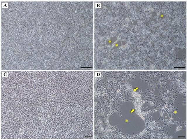 Figure 7. Uninfected SSN-1 cells (A & C). Infected SSN-1 cells (6 days post inoculation) showing multiple plaques (asterisks) and associated vacuolated cells (arrows) at the edge of the plaques (B & D). Scale bar 50 µm (C & D), Scale bar 200 µm (A & B).