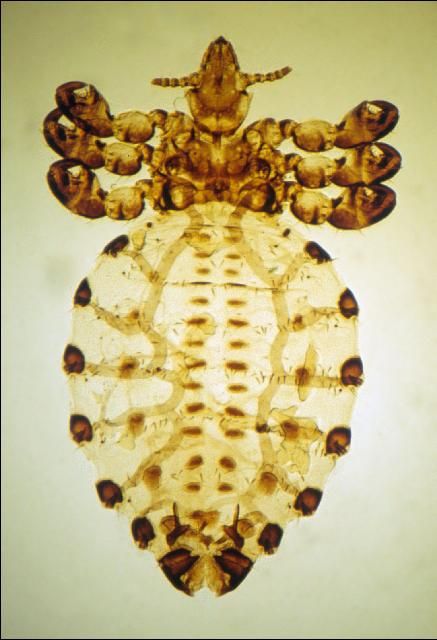 Figure 10. Cattle tail louse