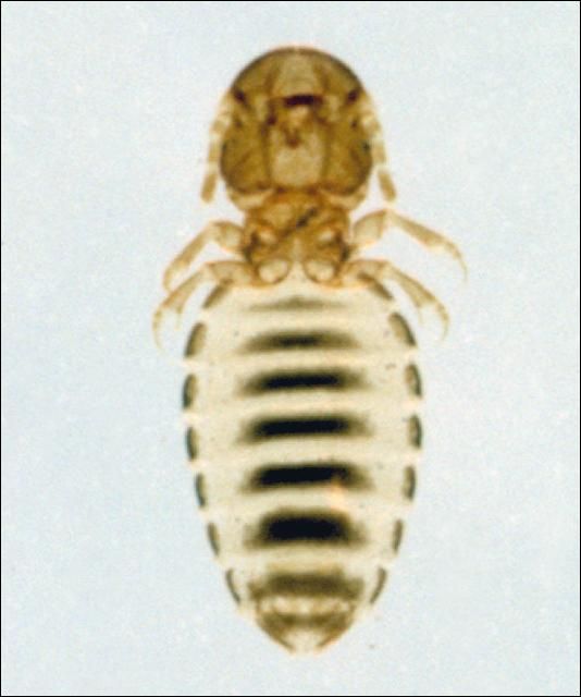 Figure 9. Biting louse
