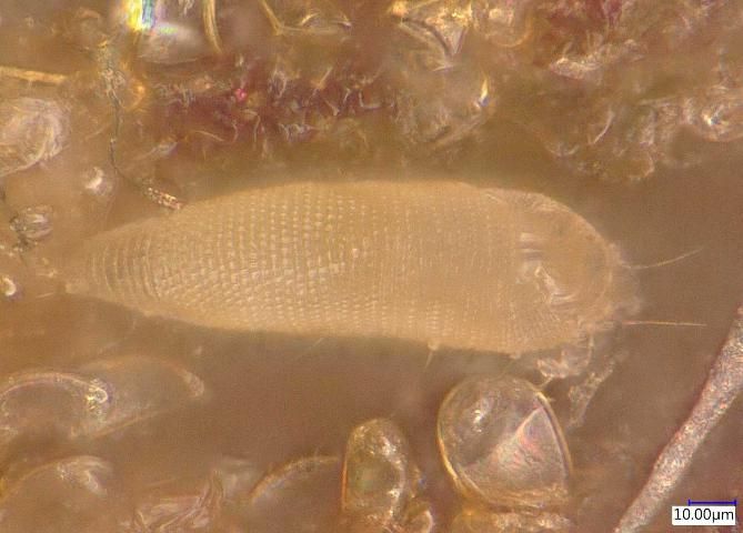 Figure 11. A close up of the Mango bud mite, Aceria mangiferae.