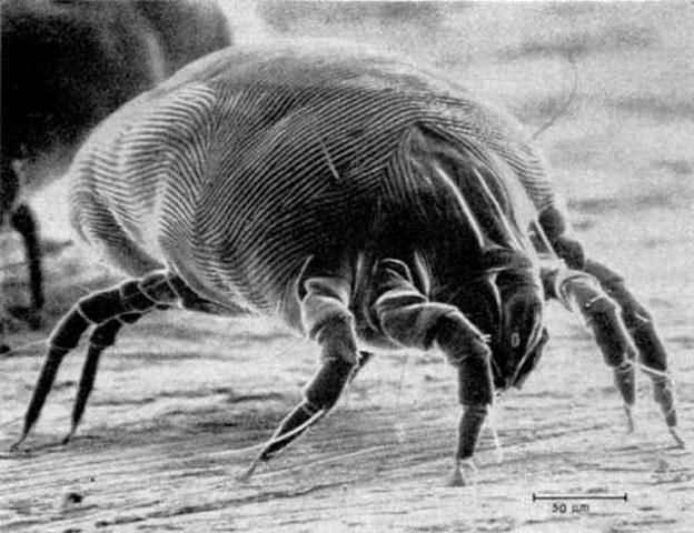 Figure 5. House dust mite (actual size 1/52 inch).