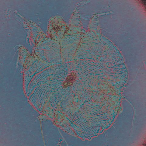 Figure 4. Scabies mite (actual size 1/64 inch).