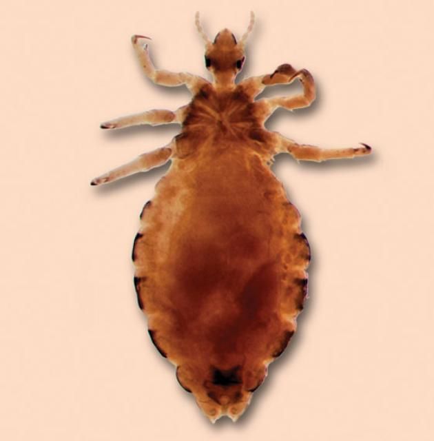 Figure 1. Head louse.
