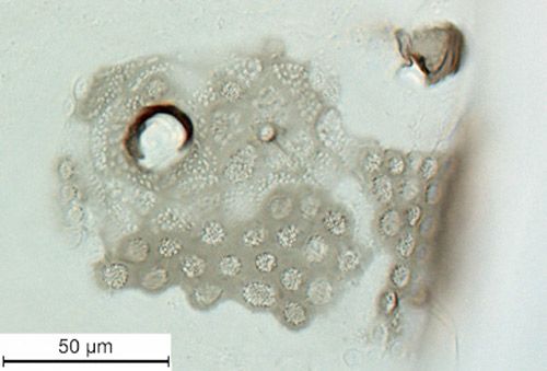 Figure 6. Diphyllaphis microtrema Quednau siphunculus.
