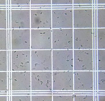Figure 3. Image of Nosema spores at 400× magnification on a hemocytometer grid. In this image, 1 of the 25 blocks (each of which contains 16 squares) that appears on the hemocytometer grid is visible.