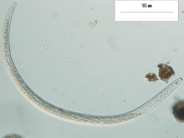 Figure 4. Female lesion nematode under high magnification.