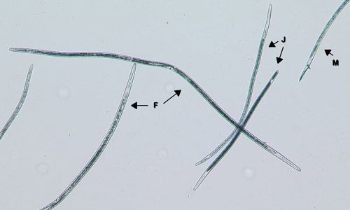 Figure 5. Sting nematode females (F), males (M), and juveniles (J) under high magnification.