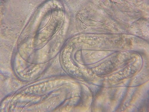 Figure 4. Mature eggs of the grass root-knot nematode, Meloidogyne graminis Whitehead. The second-stage juveniles (J2) can be seen coiled up inside indicating the egg is getting ready to hatch.