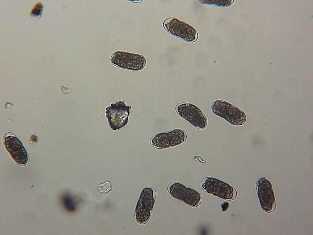 Figure 3. Young eggs of root-knot nematodes. Cells are starting to divide.