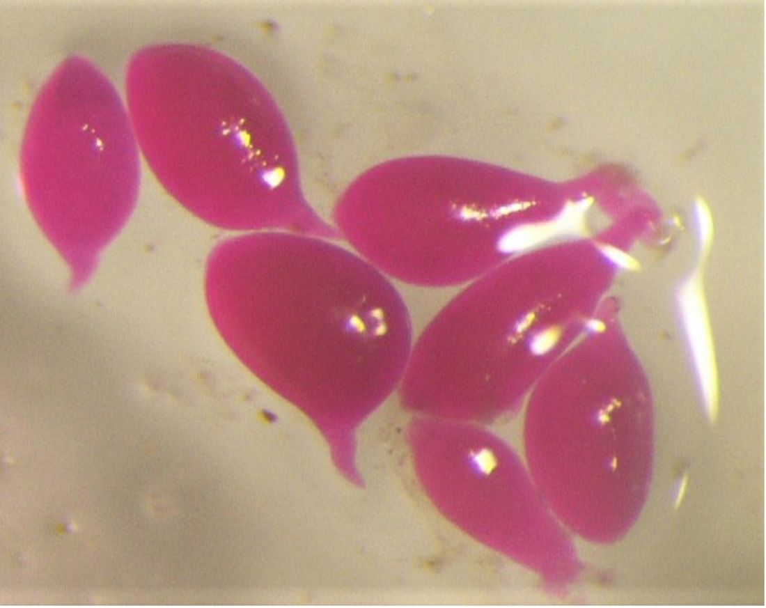 Following infection and the onset of feeding, Meloidogyne graminicola develops from a vermiform J2 into a pear-shaped adult.  These individuals were stained with a red dye.
