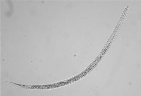 Second stage juvenile of Guava root-knot nematode Meloidogyne enterolobii at 400x magnification. 