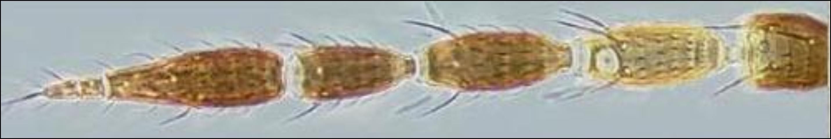 Figure 4. Antenna of the gladiolus thrips, Thrips simplex (Morison), showing the light brown segment.