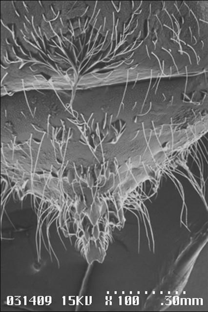 Figure 5. Dorsal view of tip of abdomen of petiole gall psyllid, Pachypsylla venusta (Osten-Sacken), showing abdominal cutting teeth—scanning electron micrograph.