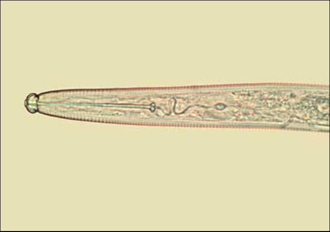 Figure 1. The head of an awl nematode in the genus Dolichodorus.