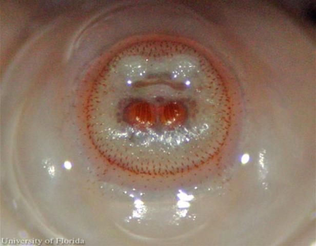 Figure 10. Posterior spiracles of the larva of the human bot fly, Dermatobia hominis (Linnaeus Jr.).