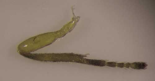 Figure 3. Hind leg of an adult female Doryctobracon areolatus (Szépligeti), a parasitoid wasp of Anastrepha spp.
