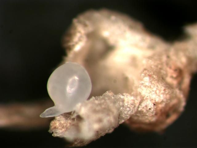 Figure 1. Mature female root-knot nematode removed from root.