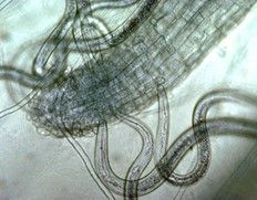 Figure 1. Migratory ectoparasites (sting nematode pictured here) insert their stylets to feed, leaving their bodies outside the root.