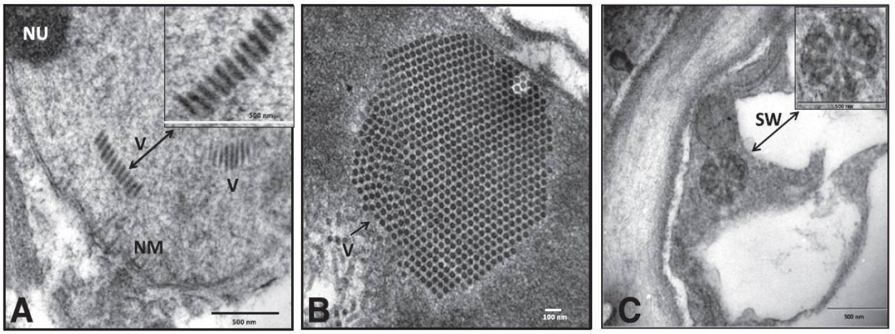 Figure 1. Transmission electron micrographs of citrus leprosis virus-infected cells. A: Nucleus containing bullet-shaped nuclear (N-type) virus particles. The boxed area is an enlarged view of virus particles. NM and NU are the nuclear membrane and nucleolus, respectively. B: Transverse section of a typical lesion from a citrus-leprosis-diseased mandarin leaf tissue showing the stacks of virus particles (V). C: Arrangement of rod-shaped virus particles (C-type) showing the spoke wheel (SW)-like configurations in the cytoplasm of the virus infected leaf. The boxed area is an enlarged view of SW arrangement.