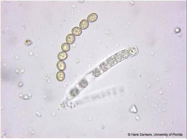 Figure 17. Ascospores (circular in shape) inside the asci (the cylindrical saclike structure) that promote the aerial spread of S. sclerotiorum.