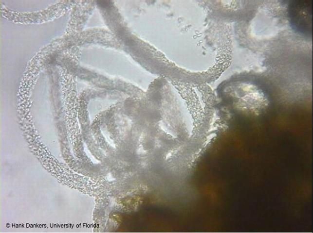 Figure 8. Conidia exuding from pycnidia in the shape of a 