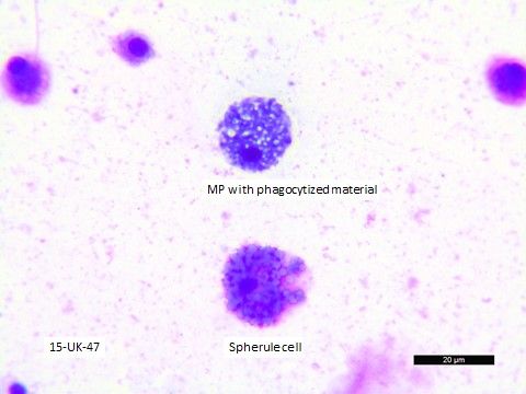 Figure 19. Coelomic fluid direct smears stained with Wright-Giemsa. MP = mononuclear phagocyte (or amoebocyte).