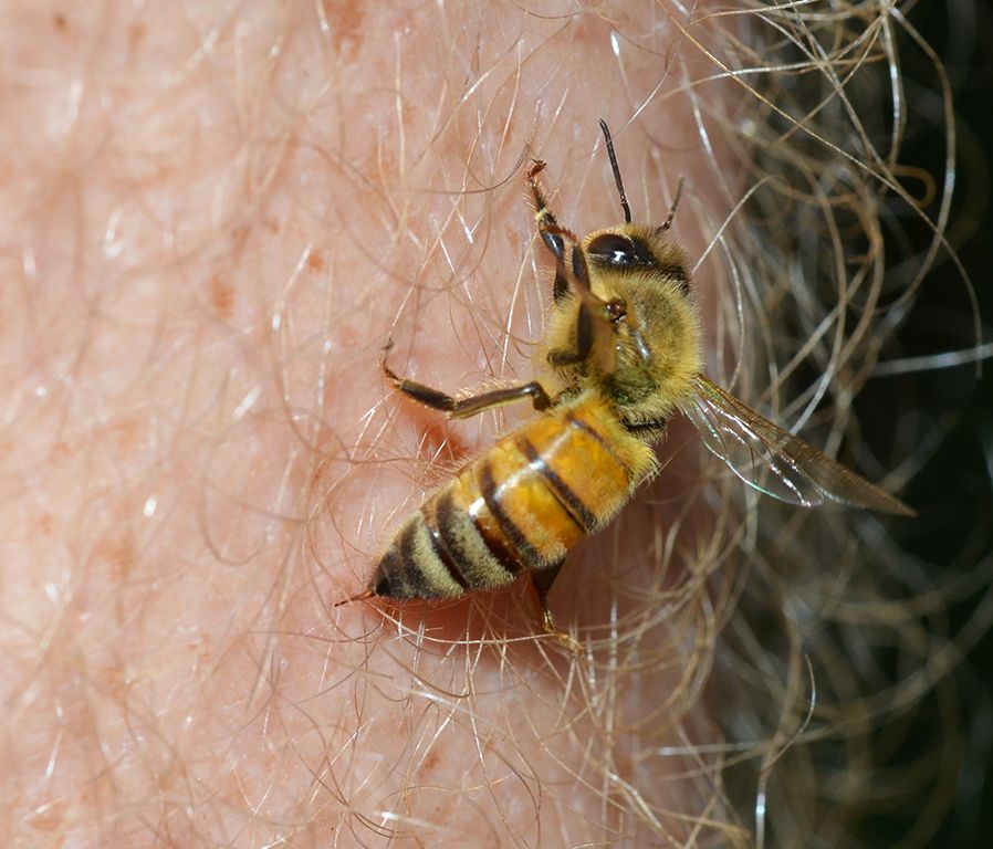 A female worker honey bee about to sting a man's arm. 