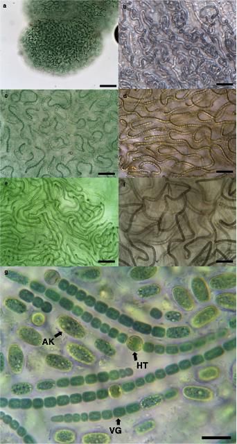 Figure 1. Microscope images of Nostoc indicating a) colony formation within mucilage, b–f) colonies of various morphologies and pigmentation, and g) individual trichomes of cells with heterocytes (HT), vegetative cells (VG), and akinetes (AK). Scale bars represent a) 100µm, b–f) 50µm, and g) 20µm.