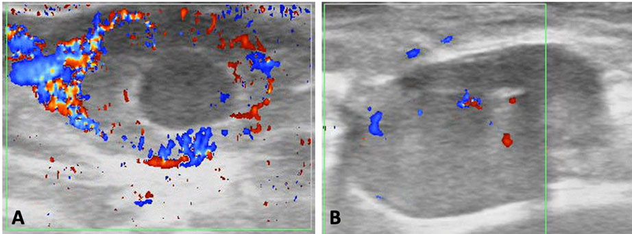 Color Doppler ultrasonographic images representing pregnant cows (A) and nonpregnant cows (B) based on vascularization of corpus luteum 20 days after AI. 