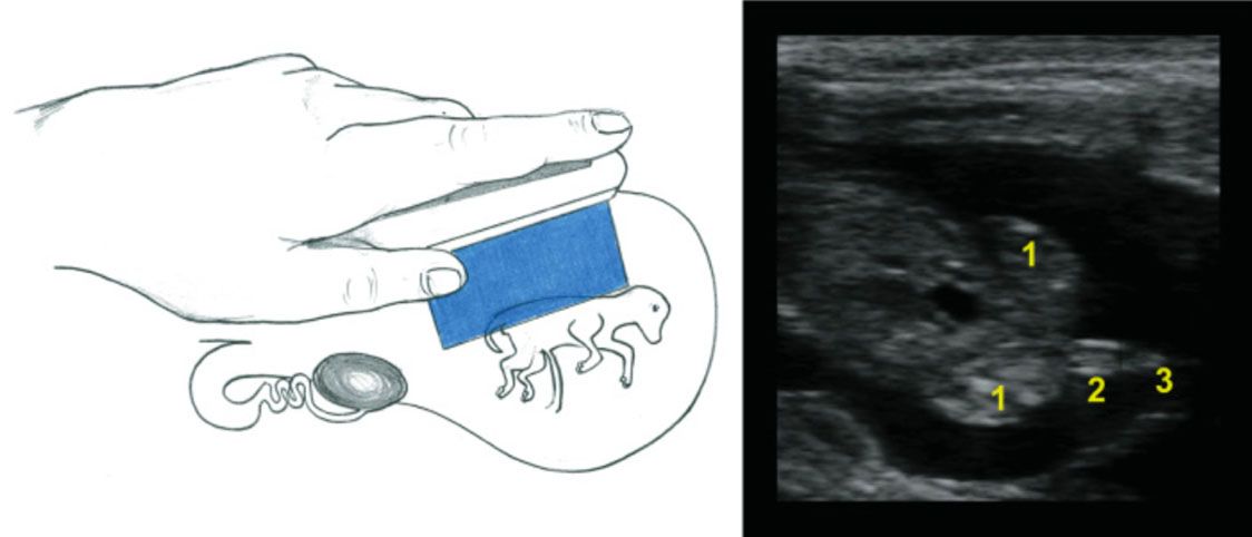 Female fetus at 60 days of gestation in longitudinal plane. The left side of the figure shows the position of the probe in relation to the fetus inside the uterus. The right side of the figure shows what will be seen on the screen at the same moment. 1: Hindlimbs; 2: Genital tubercle; 3: Tail. 