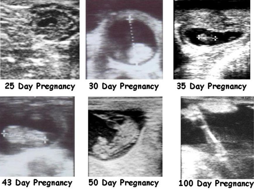 Ultrasound images of the bovine pregnancy at various stages of development.