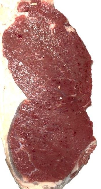 Capillary rupture or “blood splash” in muscle. 