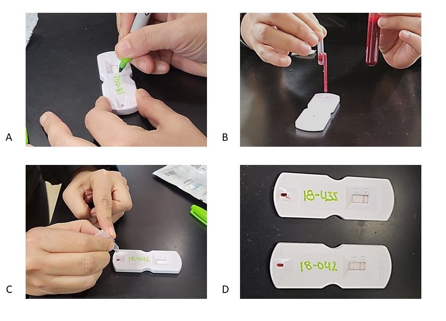 Example of chute-side processing. (A) Label the device. (B) Add a drop of the blood with the pipette. (C) Add wash solution. (D) Results arrive after 20 minutes (negative result on the top and positive result on the bottom). 