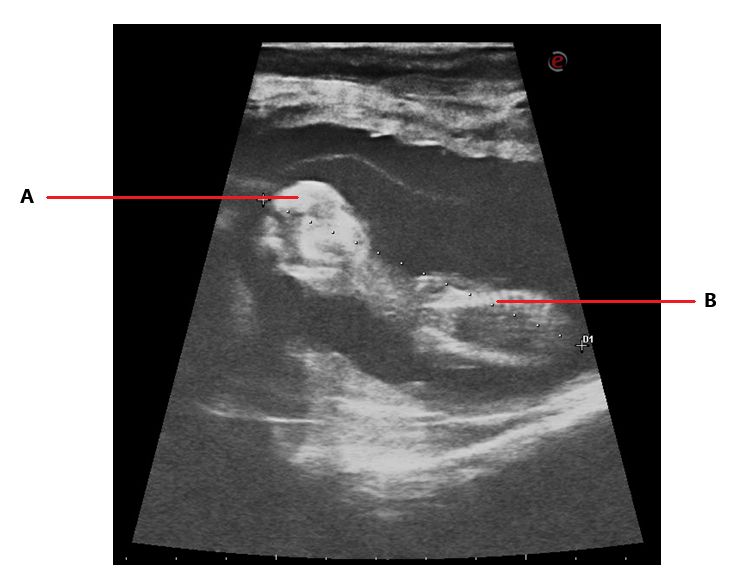 Ultrasonography image of the uterine body of a pregnant cow at 90 days. The fetus, the head (A), and the ribs (B) are clearly visible in the image. 