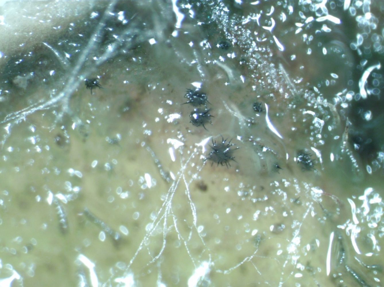 A jelly-like substance that appears wet contains small black balls with many short filaments growing from the balls making them appear spiky.