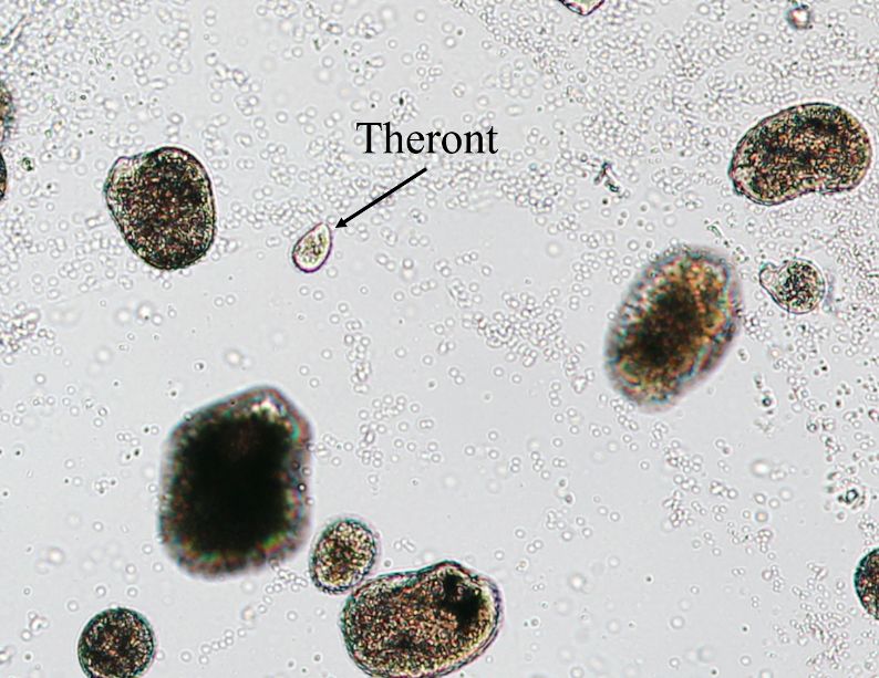 Ich of various sizes and stages including infective theront. 