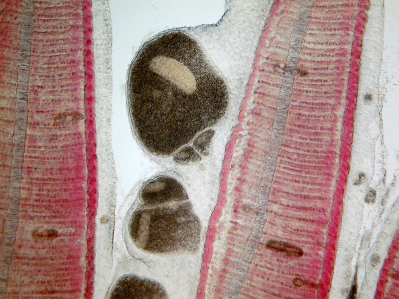 Ich feeding on gill tissue. Notice the layers of epithelium and mucus covering the adult parasites and protecting them from chemical treatment. 