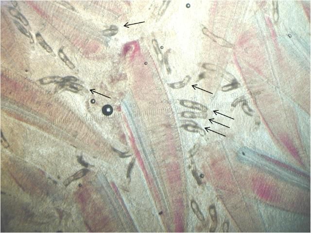 Figure 8. Heavy infestation of ancyrocephalids (some marked with arrows) on gills of convict tang Acanthurus triostegus (40x magnification).