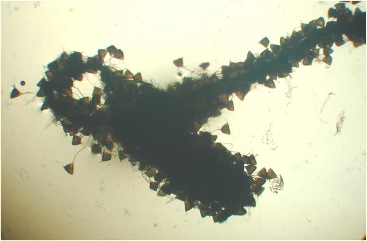 Figure 7. A capsalid egg mass from skin of lookdown Selene vomer (100x magnification).