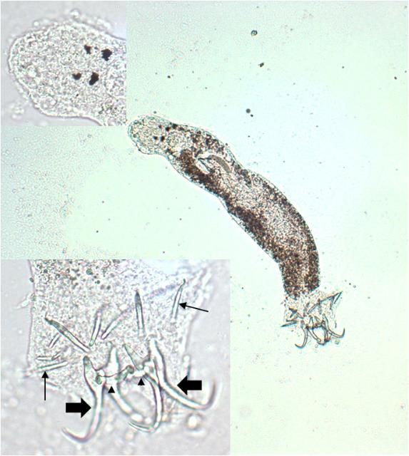 Figure 5. Ancyrocephalid (100x magnification). Upper inset: two pairs of eye spots; lower inset: two pairs of anchors (wide arrows), two transverse bars (arrowheads), and marginal hooks (narrow arrows) (400x magnification).