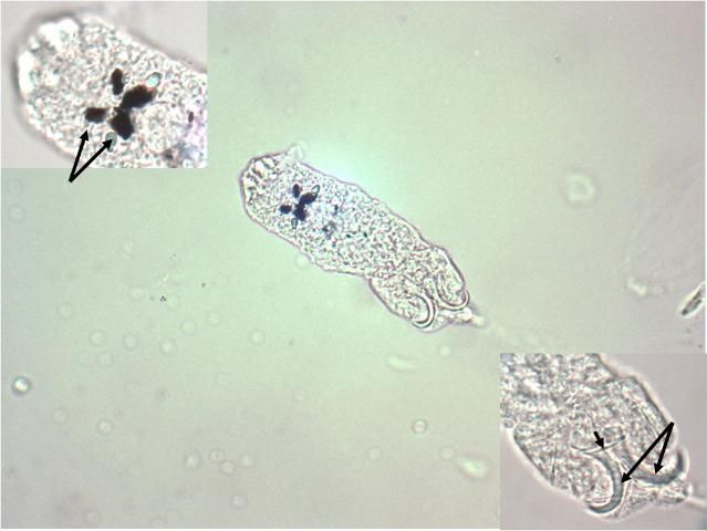 Figure 4. An immature dactylogyrid (400x magnification). Upper inset: two pairs of eye spots; lower inset: one pair of anchors (long arrows) and one transverse bar (short arrow) (1000x magnification).
