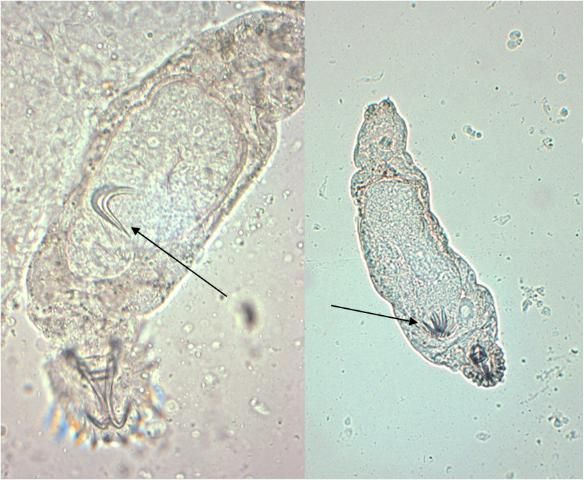 Figure 3. A gyrodactylid from the skin of a goldfish Carassius auratus. The arrows point to the anchors of embryos. Note the lack of eyespots (left, 100x magnification; right, 40x magnification).
